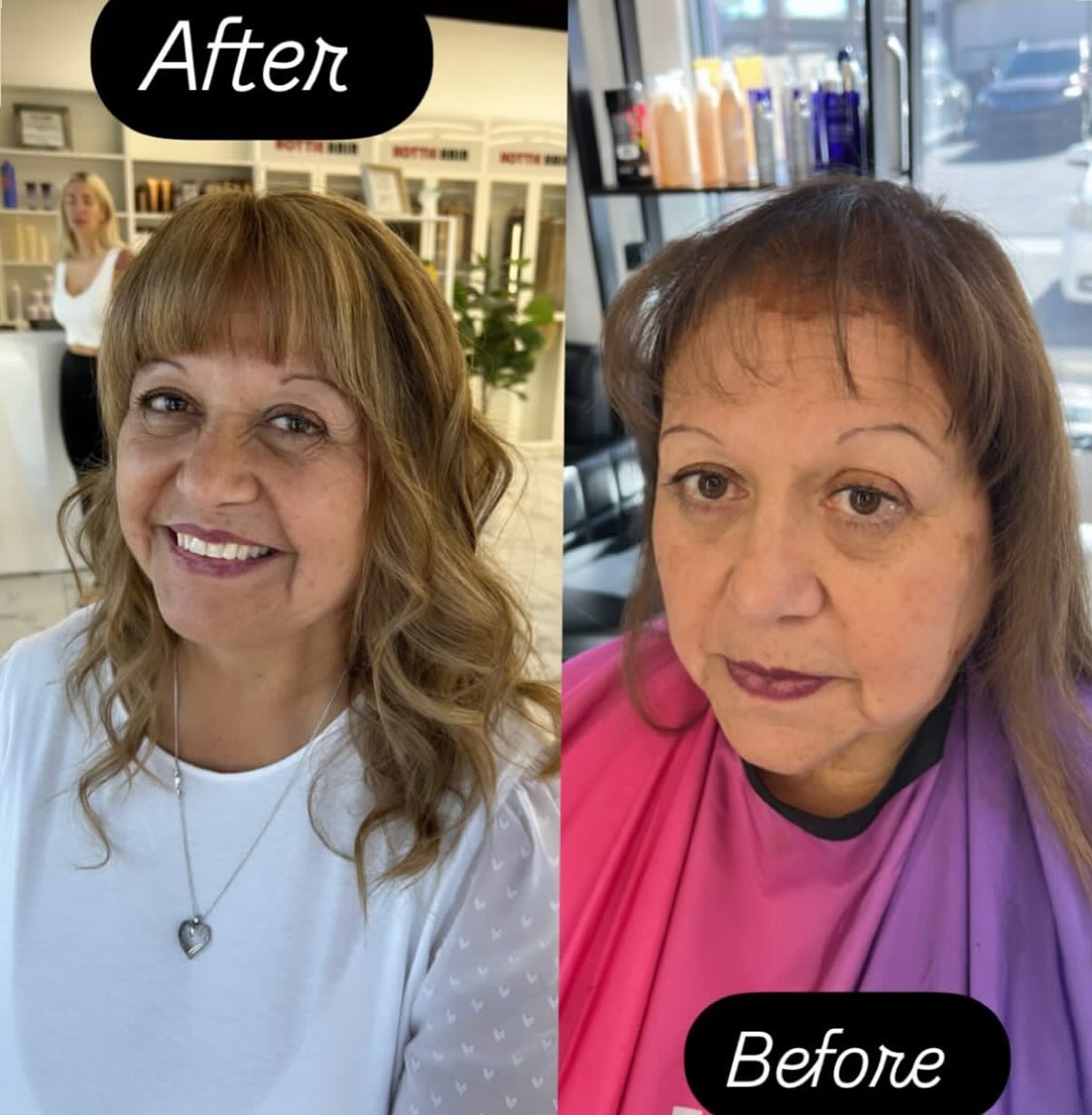 Permanent Hair Topper for Crown Thinning
